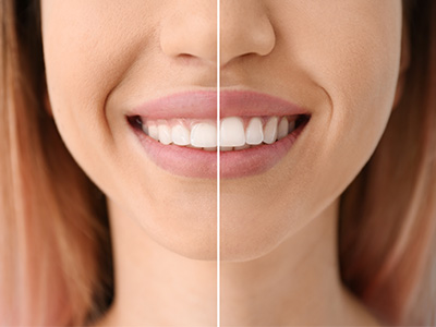 Scottsdale Cosmetic Dentist