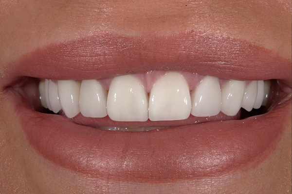 KORsmiles Dental | Veneers, Smile Makeovers and Dental Implants